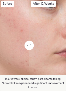 NUTRAFOL - Women’s Skin